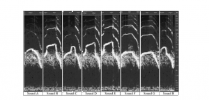 Screenshot of the Adobe® AuditionTM software showing the spectrograms of the sounds recorded on Day 1.